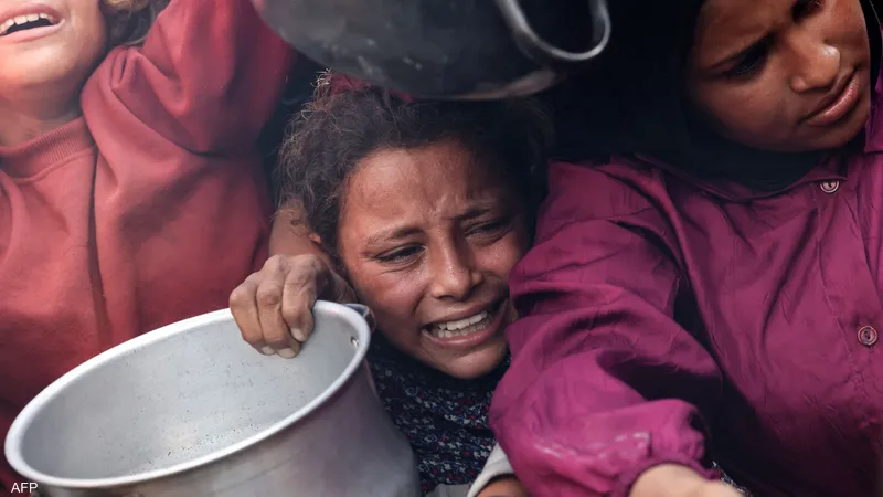 أطفال غزة.. ضحية الحرب والجوع وسوء التغذية – صورة من اليونيسف